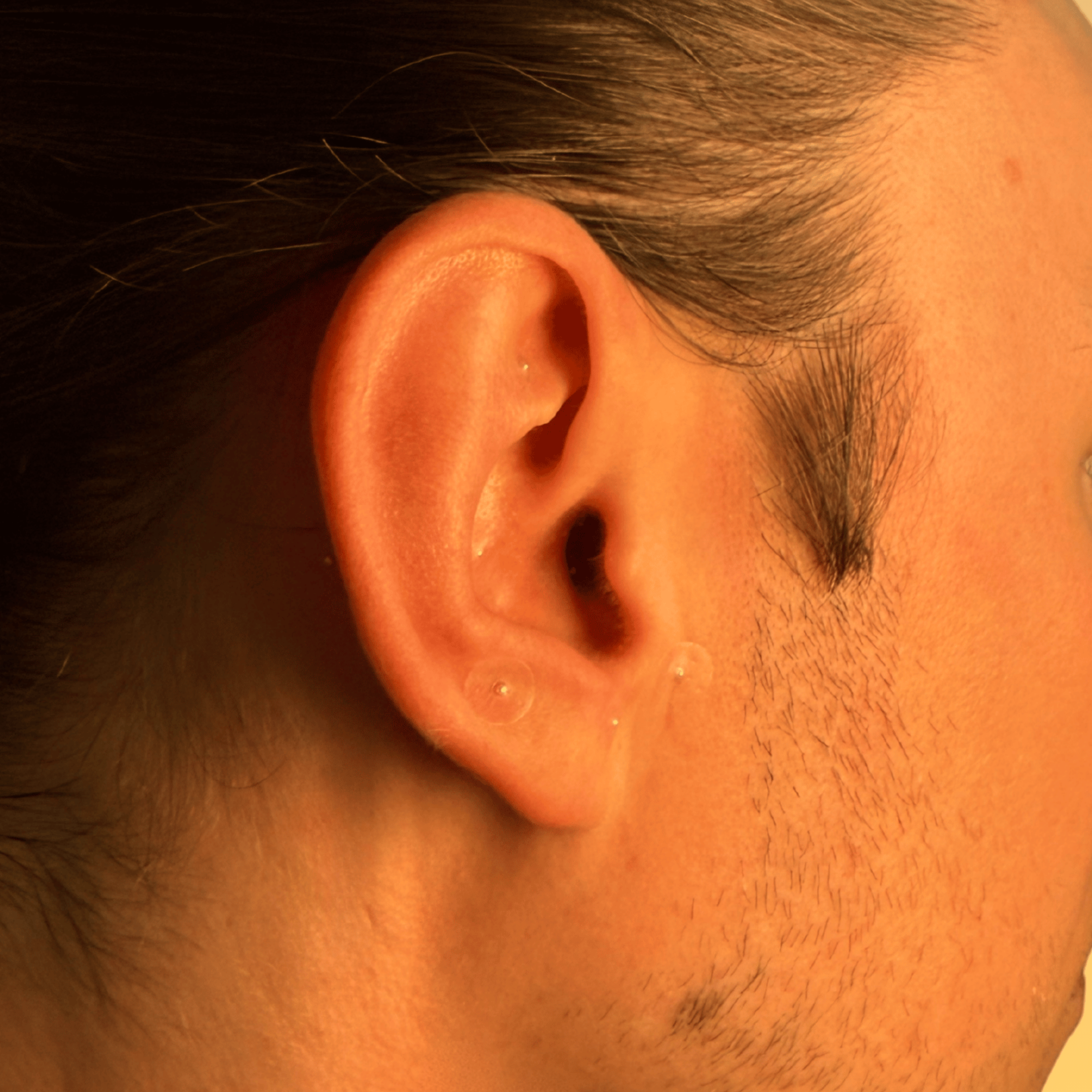 INVG Ear Seed Starter Kit (24K Gold)