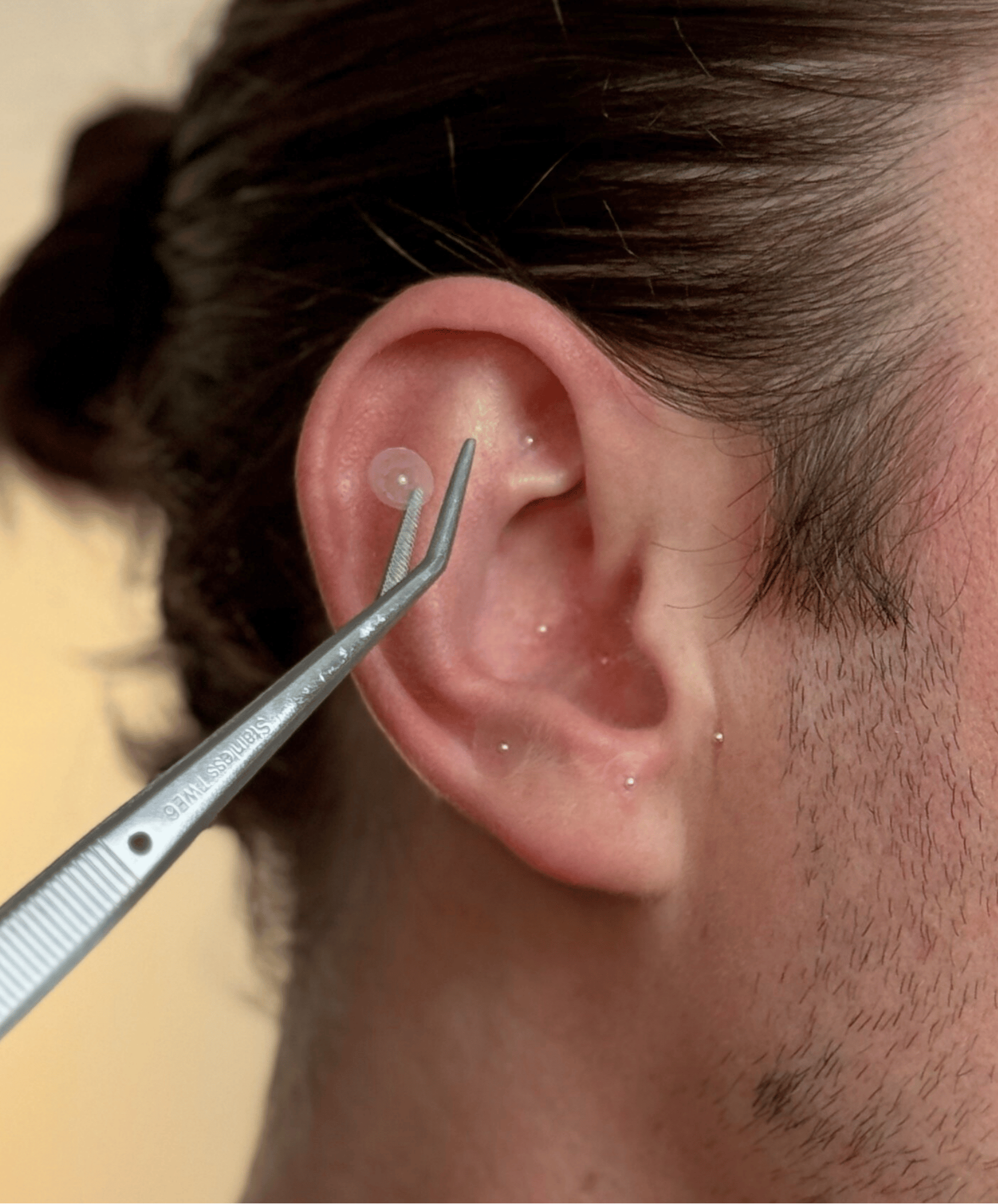 INVG Ear Seed Starter Kit (24K Gold)