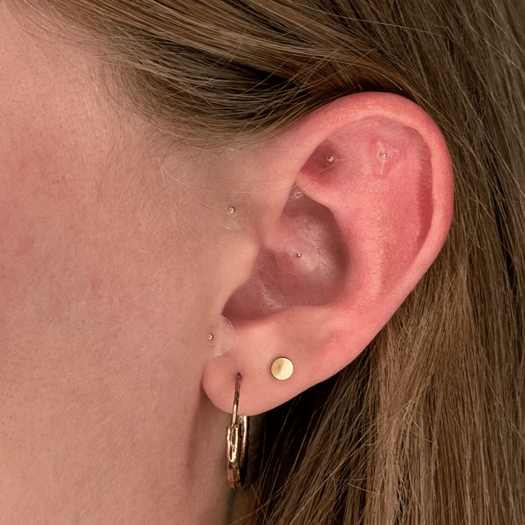 INVG Ear Seeds - INVG Wellness