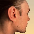 INVG Sculpt & Release Set — Skarabäus- & Gesichtsschröpfglas-Bundle